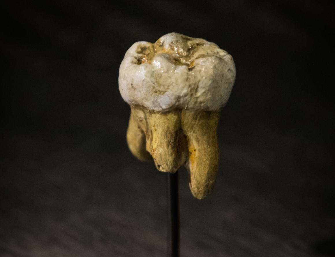 molar denisova